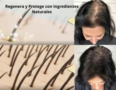 SERUM DE JENGIBRE® - Serum contra la caida del cabello. (PAGUE 1 LLEVE 2)🔥🤯