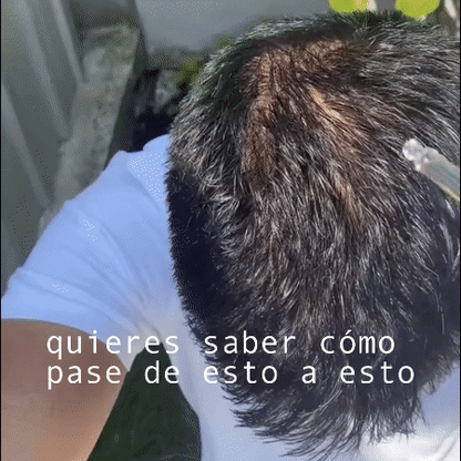 SERUM DE JENGIBRE® - Serum contra la caida del cabello. (PAGUE 1 LLEVE 2)🔥🤯